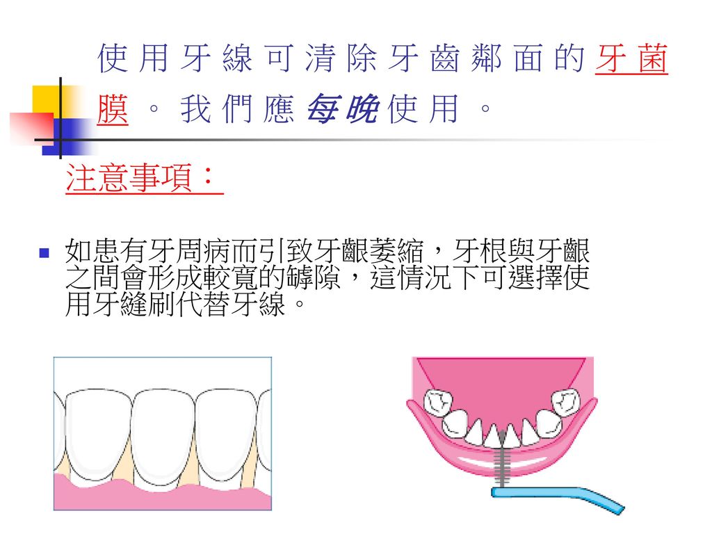 使 用 牙 線 可 清 除 牙 齒 鄰 面 的 牙 菌 膜 。 我 們 應 每 晚 使 用 。