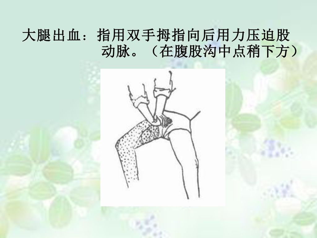 大腿出血：指用双手拇指向后用力压迫股动脉。（在腹股沟中点稍下方）