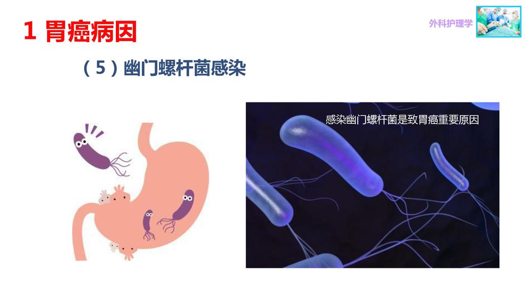 1 胃癌病因 外科护理学 （5）幽门螺杆菌感染 感染幽门螺杆菌是致胃癌重要原因