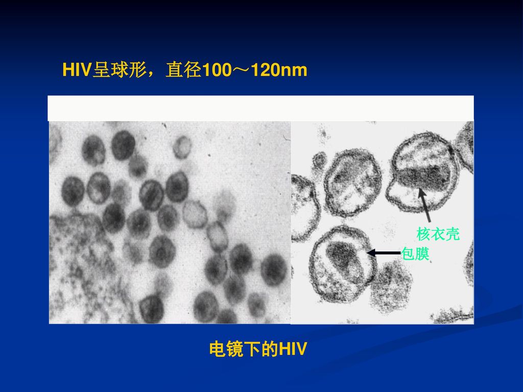 HIV呈球形，直径100～120nm 包膜 核衣壳 电镜下的HIV