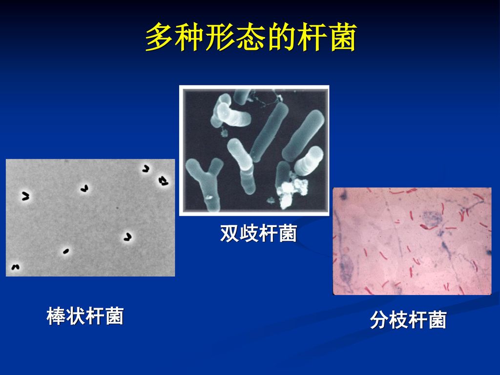 多种形态的杆菌 双歧杆菌 棒状杆菌 分枝杆菌