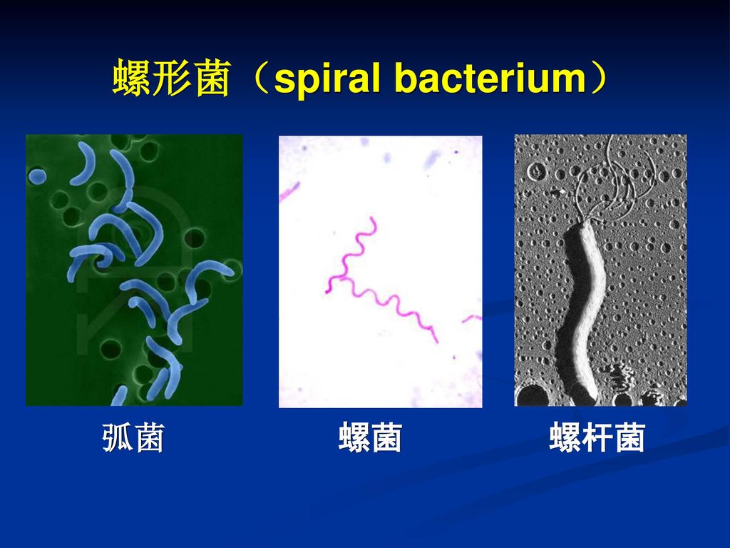 螺形菌（spiral bacterium）