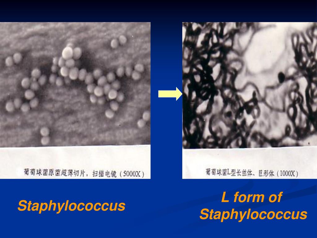 L form of Staphylococcus Staphylococcus