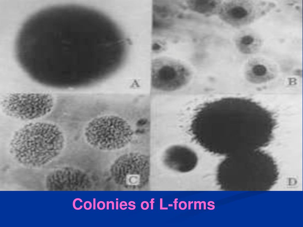 Colonies of L-forms