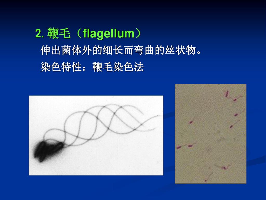 2.鞭毛（flagellum） 伸出菌体外的细长而弯曲的丝状物。 染色特性：鞭毛染色法