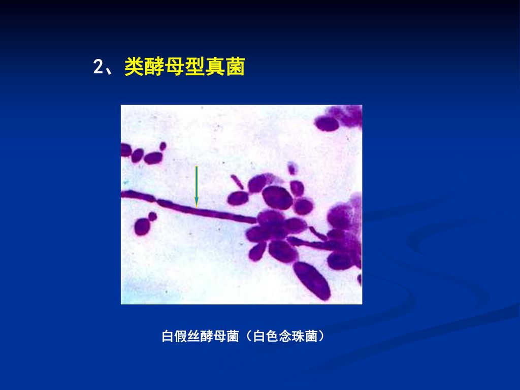 2、类酵母型真菌 白假丝酵母菌（白色念珠菌）
