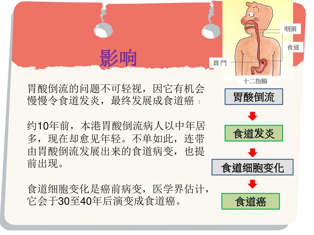 胃酸倒流 Ppt Download