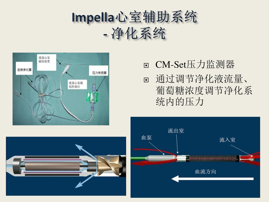 Impella心室辅助系统 - 净化系统 CM-Set压力监测器 通过调节净化液流量、葡萄糖浓度调节净化系统内的压力