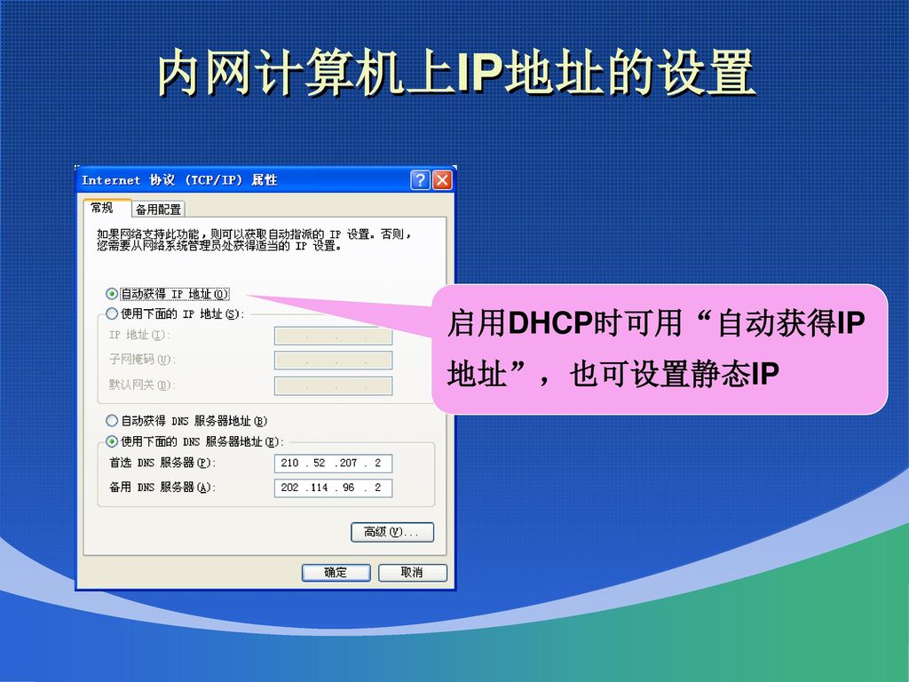 内网计算机上IP地址的设置 启用DHCP时可用 自动获得IP地址 ，也可设置静态IP
