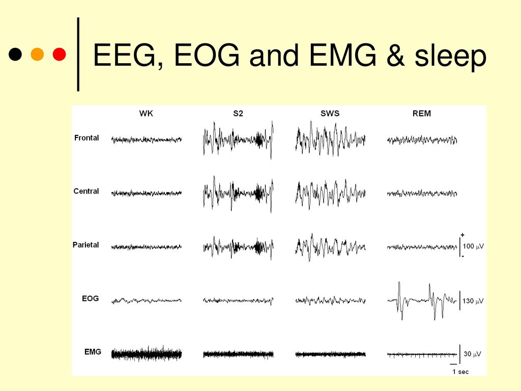 EEG, EOG and EMG & sleep