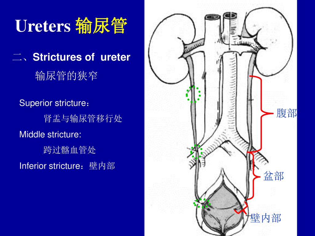 Ureters 输尿管 二、Strictures of ureter 输尿管的狭窄 腹部 盆部 壁内部