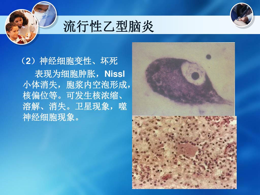 学习情境十八传染病 病理学与病理生理学 Ppt Download