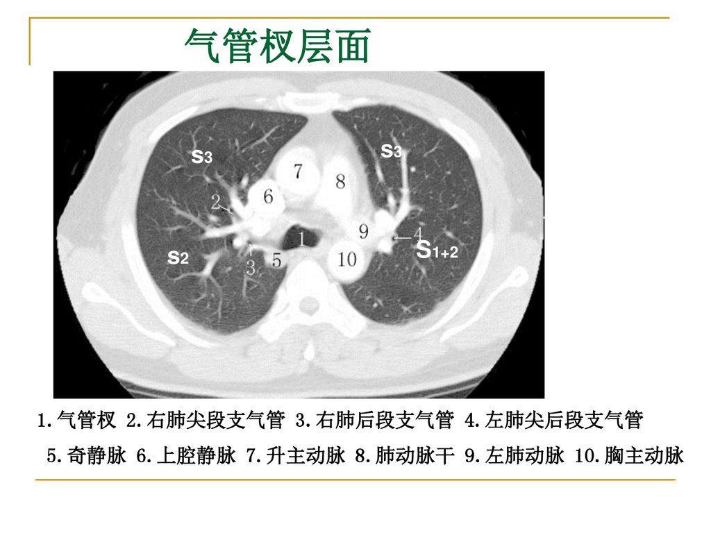 Ct肺窗解剖 Ppt Download