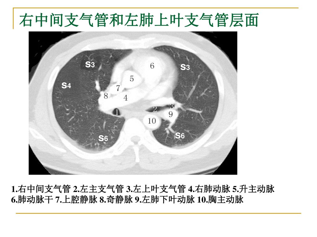 Ct肺窗解剖 Ppt Download